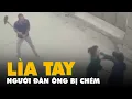 Download Lagu Trích xuất camera, điều tra vụ người đàn ông bị chém lìa tay ở Hà Nội