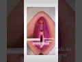 Download Lagu Anatomia
