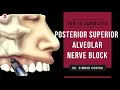 Posterior Superior Alveolar Nerve Block l PSA Nerve Block Technique l Nerve Block Injection