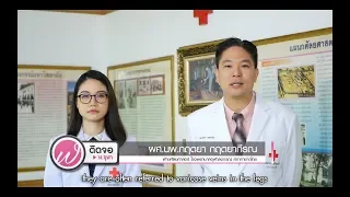เส้นเลือดขอดคืออะไร และมีอาการอย่างไรบ้าง
