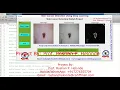 Matlab Code Skin Disease Detection Using Deep Learning Skin Disease Detection Using Matlab