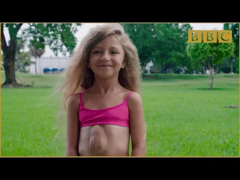 The girl born with heart outside her chest - Incredible Medicine: Dr Weston's Casebook Preview - BBC