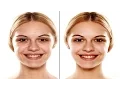 Airbrush Easy Photo Editor - Mobile App