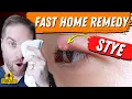 Super FAST Home Remedy For An Eyelid Stye
