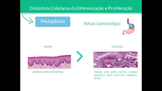 Metaplasia e Displasia - Patologia