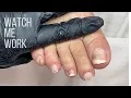 Gentle salon pedicure Bruised toenail lifted nails from micro trauma Watch Me Work