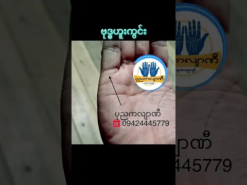 #ဗုဒ္ဓဟူးကွင်း #Mercuryring