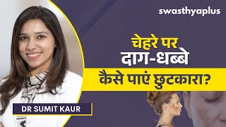 चेहरे और शरीर से काले दाग नहीं जा रहे? जानें असली कारण | Hyperpigmentation in Hindi | Dr Sumit Kaur