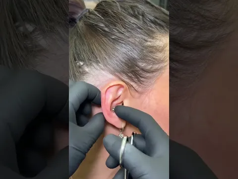 how a conch piercing is done 👀