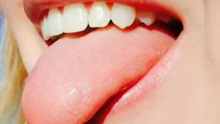 رقية شرعية لعلاج ثقل اللسان وحبس الكلام 