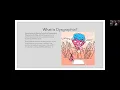Module 4 Assignment Learning Disability Presentation - Dysgraphia