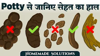 12 ज़रूरी बातें जो हमारा मल बताता है हमारी सेहत के बारे में | Things Stool Says About Your Health