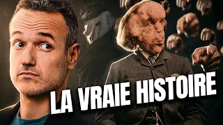 Joseph Merrick, l'Histoire du Monstre qui n'en était Pas un (alors que nous oui)