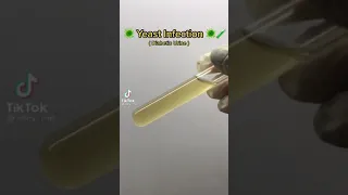 Yeast Infection As Seen Under The Microscope Shorts Shorts 