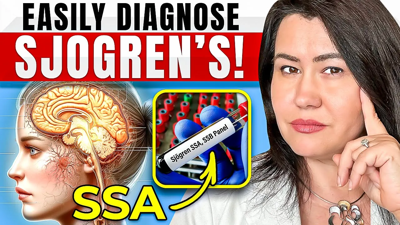 Essential Sjogren's Disease Tests to Ask Your Doctor About NOW