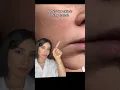 Download Lagu Top 10 Tips to Hydrate Your Dehydrated Skin#skincare #viral #medical