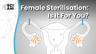 Female sterilisation Is it for you
