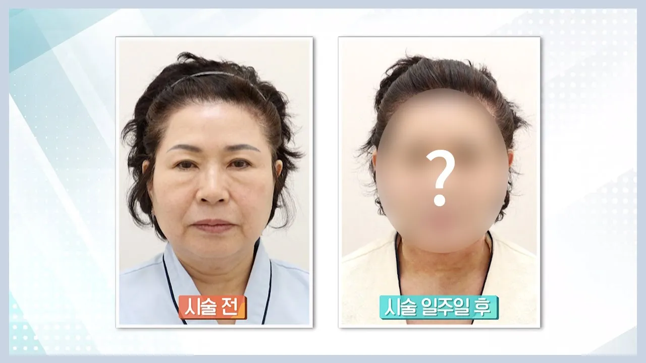 [NOTE.PRS] 나도 갖고싶다 동안얼굴! 그 비결은?