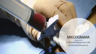MIELOGRAMA: Técnica e interpretação