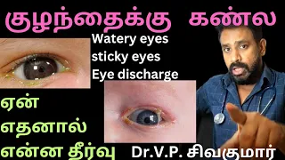 are babys eyes always dirty sticky newborn eye discharge sticky eyes watery eyes