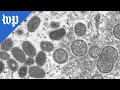 How monkeypox spreads
