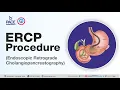 What is ERCP Test and How it is done Department of Gastroenterology - Pace Hospitals