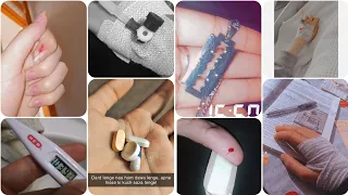 Accident Dp Ideas 2023 Hand Bandage Dp For Boys And Girls Hand Dp Cannula Hand Dp Photo 