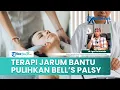 Atasi Bell's Palsy dengan Dry Needling, Terapi Jarum untuk Atasi Kelumpuhan Wajah, Ini Manfaatnya