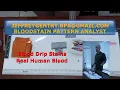 BLOODSTAIN PATTERN ANALYSIS BLOOD DRIP STAINS ON MULTIPLE SURFACES JEFFREYGENTRY BPA GMAIL COM