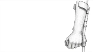 Medicina física y rehabilitación pediátrica en trauma y amputaciones por desastres