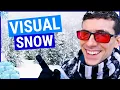 What is Visual Snow Symptoms and Treatments