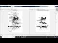 Beautiful Application of extraction of largest binary object from Image MATLAB