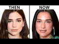 Plastic Surgeon Reacts To Dua Lipa s NEW FACE