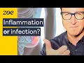 Lagu CHRONIC Diarrhea? Here's What To Do | Dr. Will Bulsiewicz