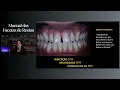 Channel