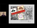 Imaging of inner ear malformations my webinar for the ESPR with Dr Ata Siddiqui