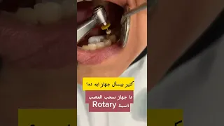 جهاز سحب عصب الأسنان                                                           دكتور عبدالله سلطان دندنها