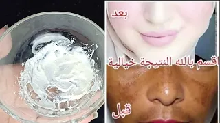 والله ثم والله أقوى وصفة لتبييض الوجه والجسم من التصبغات والبقع جربتها صدمتني بروعتهافي تبيض البشرة 