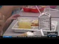 Doctors concerned with high caloric food in new Universal School Meals Program