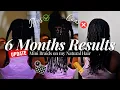 Mini Braids Made My Hair GROW Like CRAZY Pros and Cons of Mini Braids