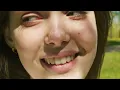 The Science of Facial Symmetry Why Some Faces Look Effortlessly Attractive