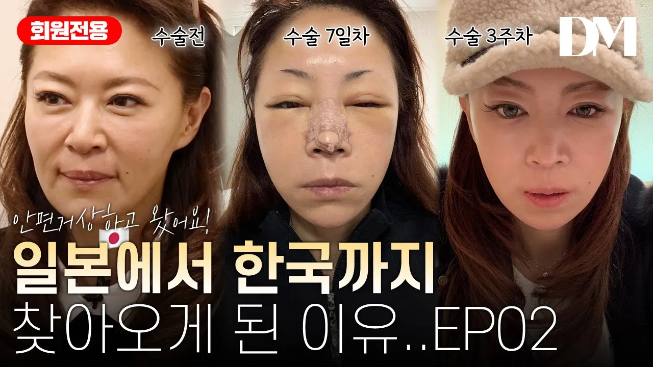 일본에서 한국까지 찾아온 이유.. 2부 (feat.. 안면거상)