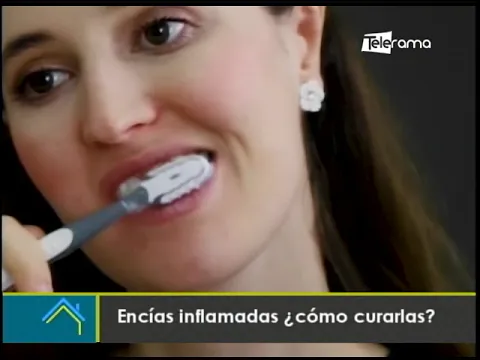 Encías inflamadas ¿Cómo curarlas?