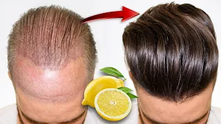 Fast Hair Growth Secret Remedy | Lemon For Permanent Hair Growth and Remove Dandruff Instunt