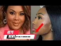 Yung Miami New Face Surgery SHE ASKED FOR THE VIVICA FOX TREATMENT