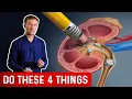 Preventing High Oxalate Kidney Stones