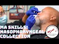 Medical Assistant Skills Nasopharyngeal Collection