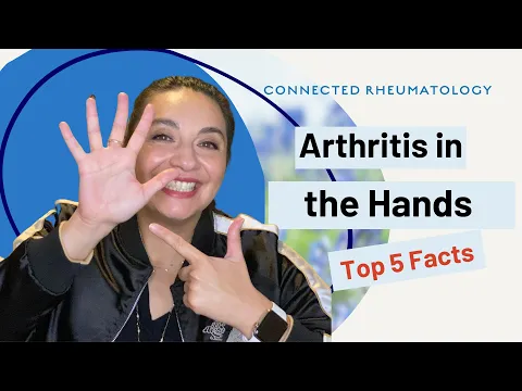 Arthritis in the Hands//Top 5 Facts to know when you have hand arthritis