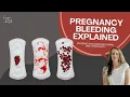 Bleeding and cramping during early pregnancy