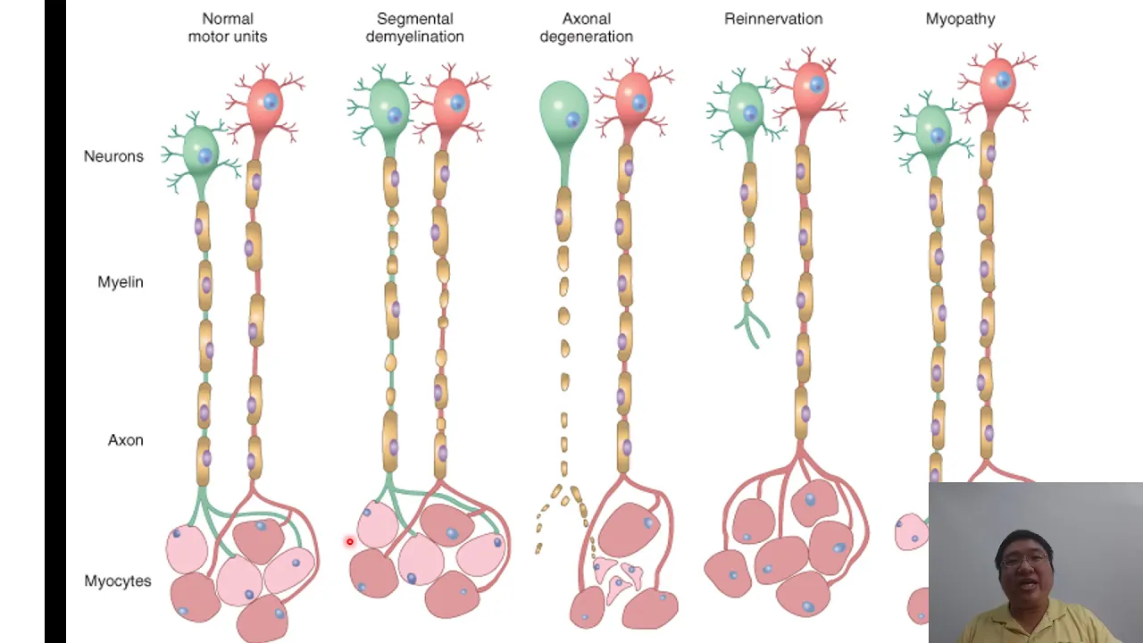 Pathology of the peripheral nervous system